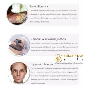 مشخصات لیزر کیوسوییچ رومیزی adss