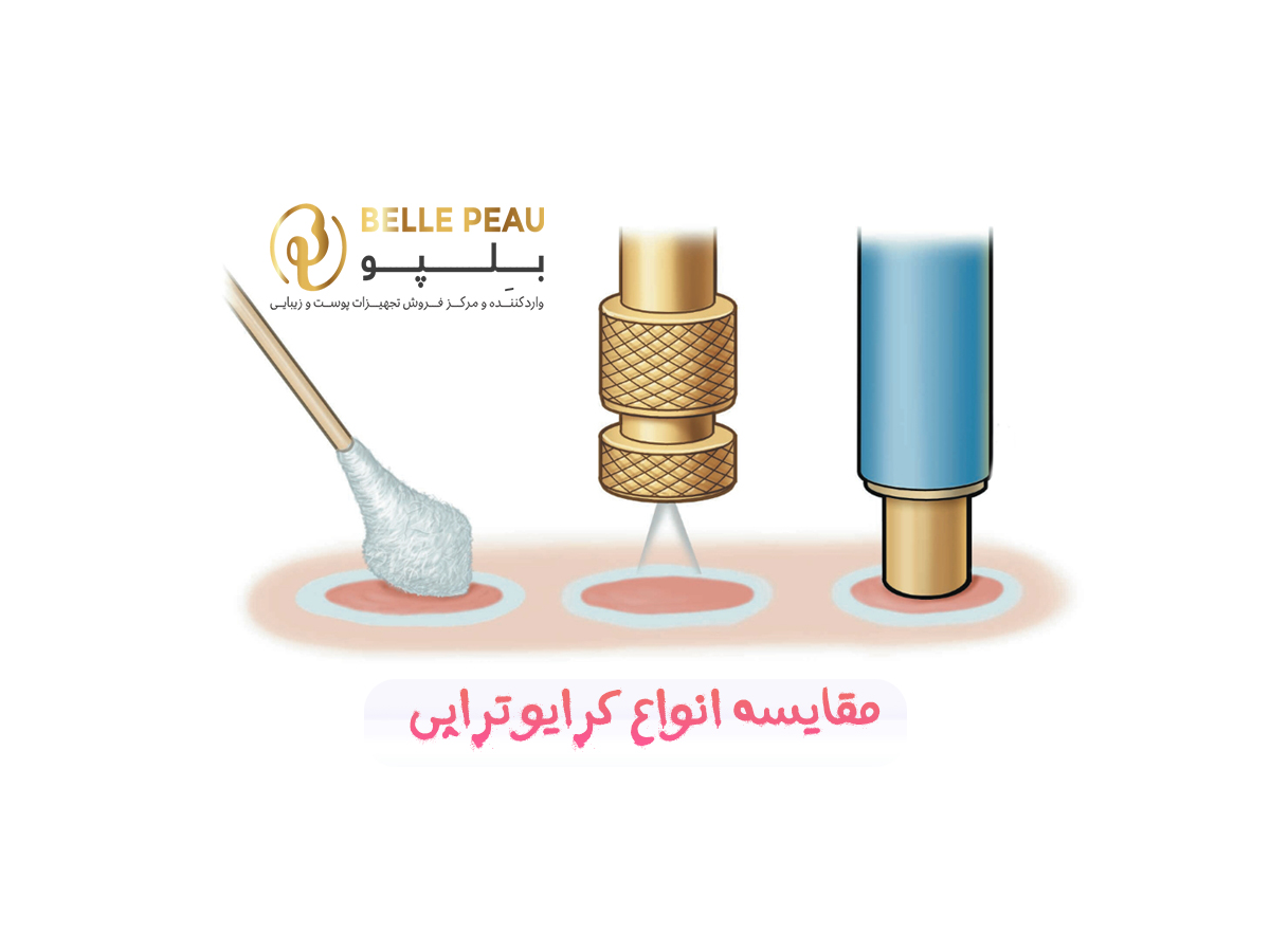 مقایسه انواع کرایو