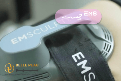 ems چیست
