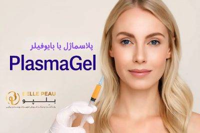 دستگاه بایوفیلر یا پلاسما ژل چیست